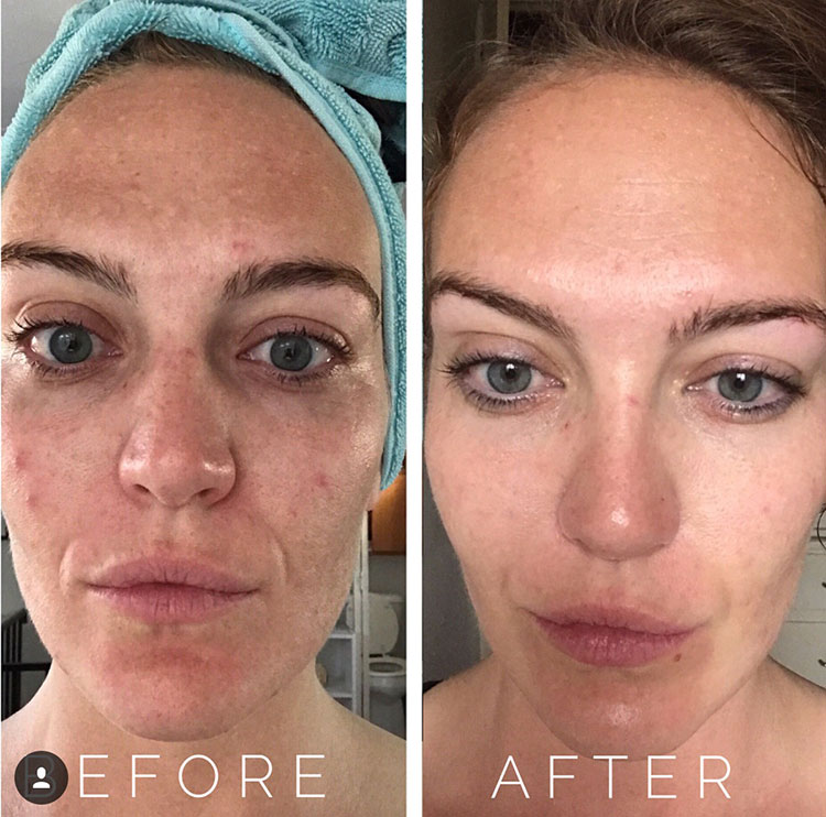 Active Wash CCS AX5 Glycolic